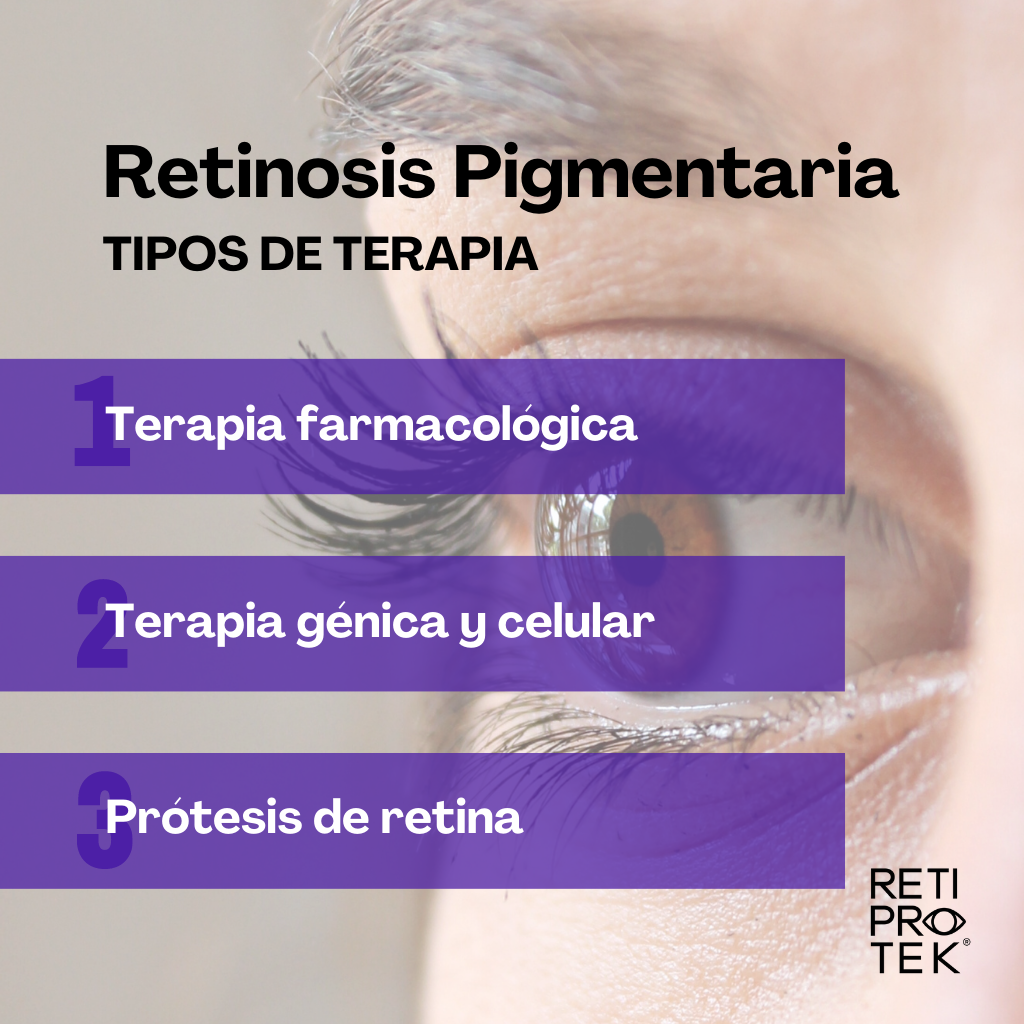 retinosis-pigmentaria-imagen_RETIPROTEK